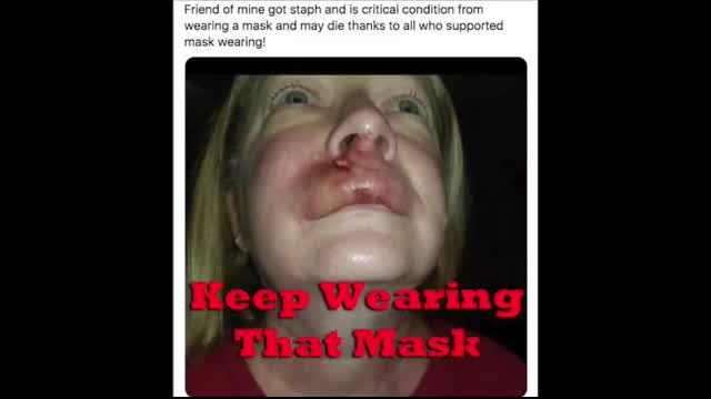 THIS IS WHAT YOU GET - KEEP WEARING THAT MASK