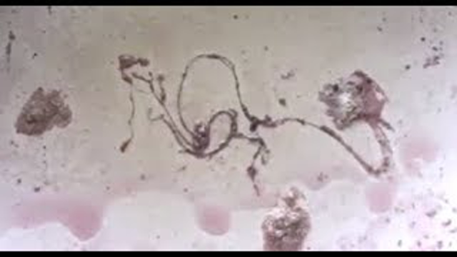 (Pre-face mask) My face mask fiber Morgellons Nanotechnology Nanotech parasite test and How It Relates to the genocide of the human race