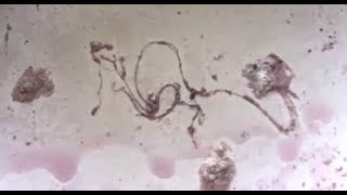 (Pre-face mask) My face mask fiber Morgellons Nanotechnology Nanotech parasite test and How It Relates to the genocide of the human race