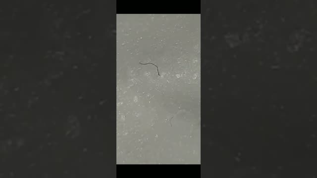 parasites that look like little worms on medical face masks that have forced us to wear