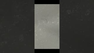 parasites that look like little worms on medical face masks that have forced us to wear