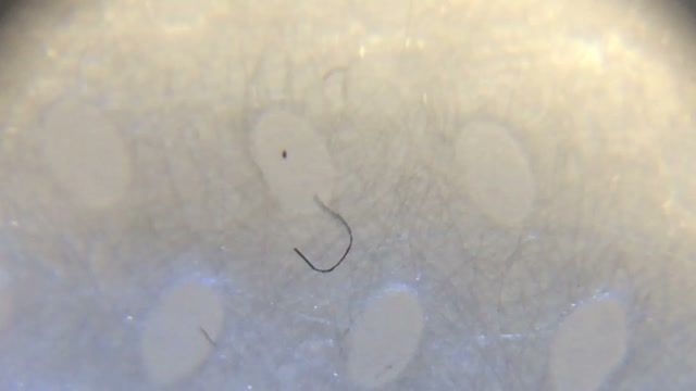 Morgellon fibers on childrenâ€™s face mask?