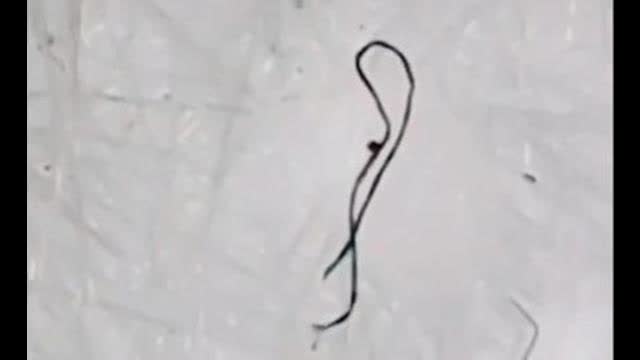 FOUND ON MASKS & SWABS: Moving Black Strands/ Parasites? What The Heck Are They?!