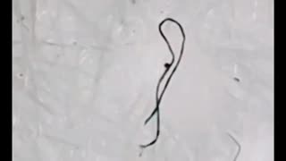 FOUND ON MASKS & SWABS: Moving Black Strands/ Parasites? What The Heck Are They?!