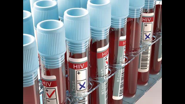 ðŸš¨ ALARMING VIDEO: DO NOT TAKE CV19 VACCINE OR PCR TEST UNTIL WATCHING THIS VIDEO!!