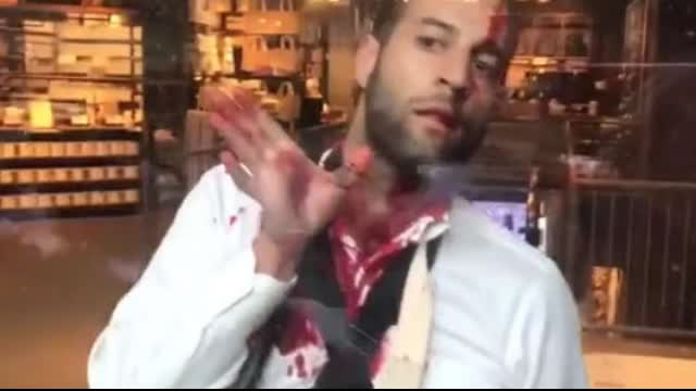 Proud Jew Left Bloodied at Anti Israeli Protest in NYC