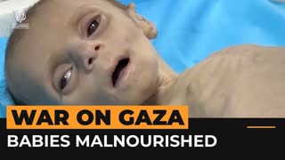 Babies are dying of hunger and dehydration in Gaza