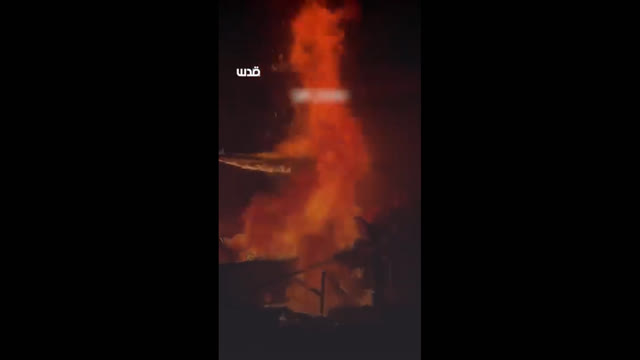 Ahmed Mansour Palestinian journalist, where Israel burned him alive, at Nasser Hospital in Khan Younis southern Gaza,