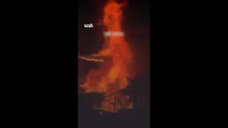 Ahmed Mansour Palestinian journalist, where Israel burned him alive, at Nasser Hospital in Khan Younis southern Gaza,