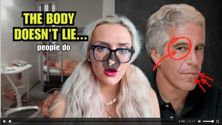 A Mortician Explains Why Jeffrey Epstein Photo Doesn't Make Sense