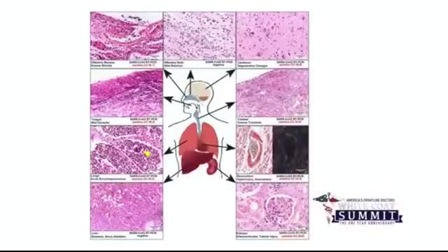 MUST SEE - Dr Ryan Cole - Covid Vaccine Effects Autopsies Summit