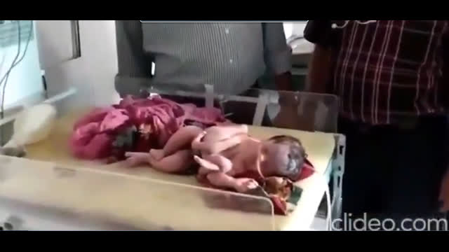 MUTANT BABIES - Is This Possibly A New Product Of The MRNA Kill Shot