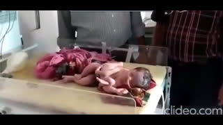 MUTANT BABIES - Is This Possibly A New Product Of The MRNA Kill Shot