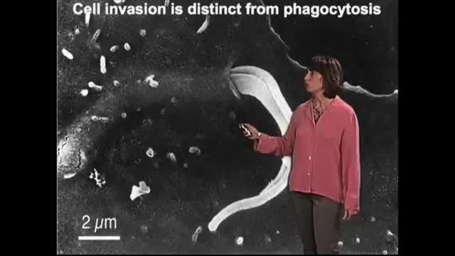 PFIZER Contains TRYPANOSOMA CRUZI PARASITE, American Scientists Confirm Graphene Oxide In Vaccines