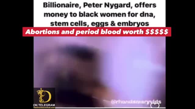 Billionaire tries to buy black woman stem cellsðŸ©¸â€¦. Listen to what he says about how much it's worth!!!