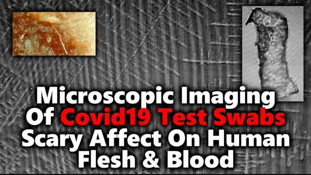 â£Covid Test Swabs up Close - New Report Claims Test Fibers Packed Dangerous DARPA Hydrogel & Lithium