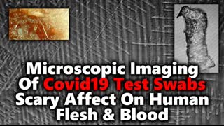 â£Covid Test Swabs up Close - New Report Claims Test Fibers Packed Dangerous DARPA Hydrogel & Lithium