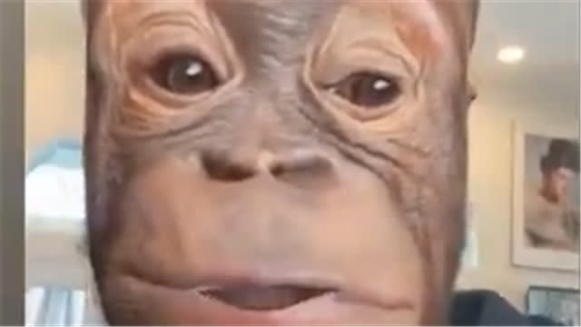 After Jew Flu Now We Have Jewpox