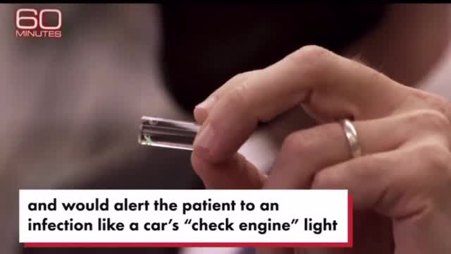 MICROCHIPPING IS HERE