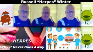 Russell Winter I Have Herpes Admission Leaves Jim Fetzer Joachim Hagopian Victor Hugo Speechless
