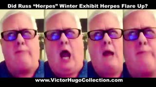 Russ Winter Exhibits Herpes Flare Up Symptoms Madly Describing Victor Hugo Audience To Jim Fetzer