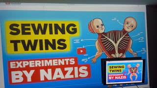 Eric Hunt - Exposes Mengele Nonsense, May 5, 2025