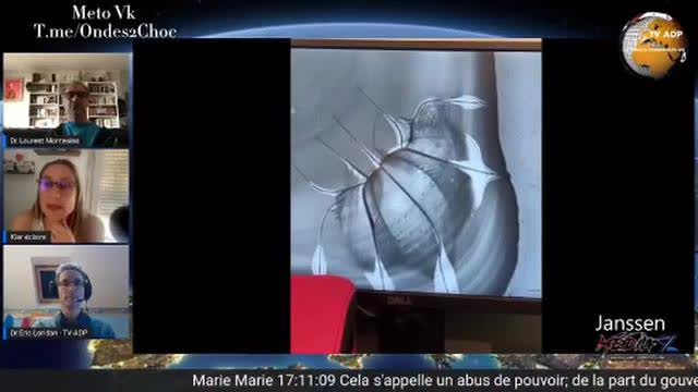 Janssens - Pfizer vaccins sous microscope