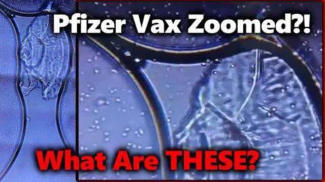 DISTURBING! PFIZER VACCINE ZOOMED W/ MICROSCOPE?! ARE LIVING CELLS/ ORGANISMS MIXED IN?!