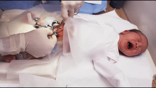 Child Circumcision: An Elephant in the Hospital