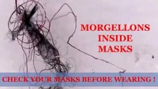 MORGELLONS ON SLAVE MASKS, SWABS, EVERYWHERE!!!!
