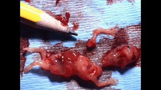 The Truth About Birth Control : Best Documentary Of All Time