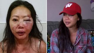 Oriental Actvists Blame Whitey For Hate Attacks Committed by Negroids