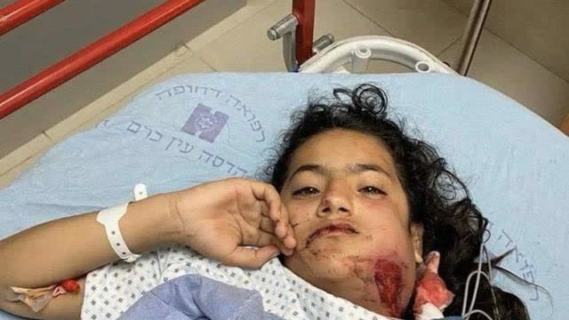 This is 12yr-old Munawar Burgan. Her jaw broken, lost 3 teeth after Israeli police attacked her..