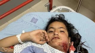 This is 12yr-old Munawar Burgan. Her jaw broken, lost 3 teeth after Israeli police attacked her..