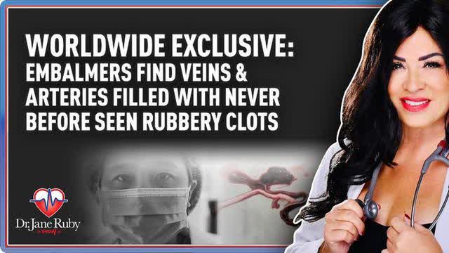 Embalmers find veins & arteries filled with never before seen rubbery clots -Dr. Jane Ruby