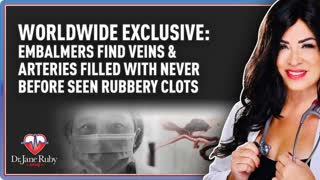 Embalmers find veins & arteries filled with never before seen rubbery clots -Dr. Jane Ruby