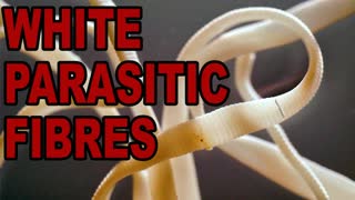 Parasitic white fibres entwined with blood clots, removed from the inoculated