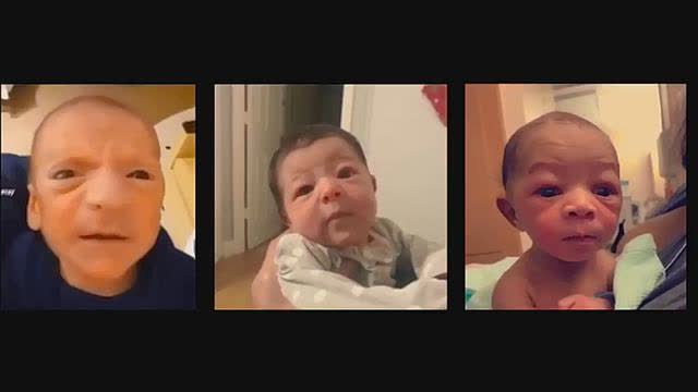 BLACK EYED BABIES & CHILDREN: A LINK TO VACCINATION PROGRAMS