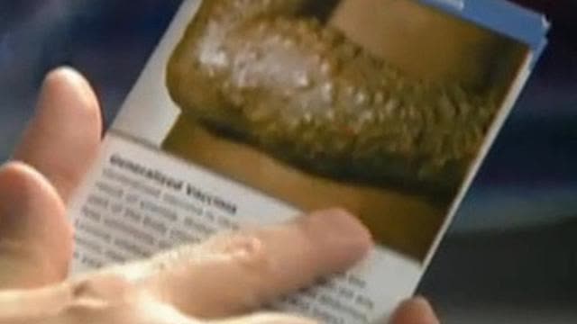 Smallpox, the most dangerous vaccine prior to Convid