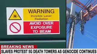 VACCINE INDUCED HEART ATTACKS SPREADING TO THE UN-VACCINATED DUE TO SPIKE PROTEIN SHEDDING...