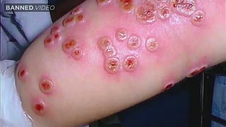 Did The CDC Start A New Pandemic In Pennsylvania?