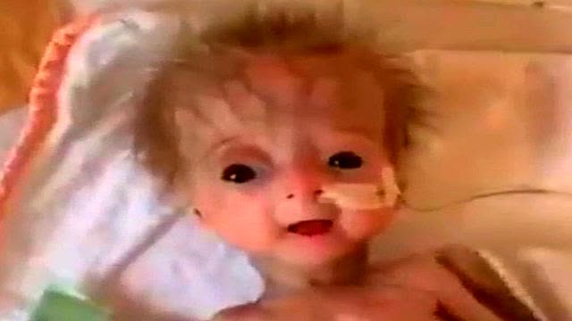 JABBED PARENTS R GIVING BIRTH 2 BLACK EYED MONSTERS