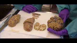 Plastic In Your Brain