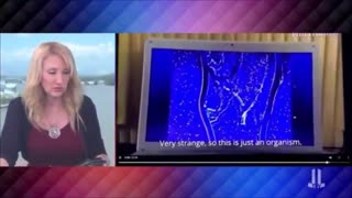 MORGELLONS IN VAX AND MASK