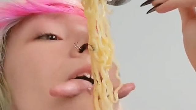 Noodle grabber tongue. The real question is what surgeon would willingly do this to someone??