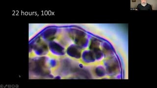 DENTAL ANESTHETIC CARBOCAINE INTRODUCED TO HUMAN BLOOD (DR. LEN BER) STUDY RESULTS