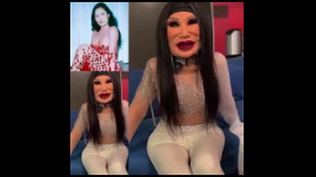 THIS WOMAN WHO USED BOTOX BECAUSE SHE FEARED AGING ⚢ HAS STARTED A DISCUSSION ABOUT BEAUTY STANDARDS