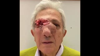 Apparently this happened to him after the vaccine...Jesus what are they doing to people ðŸ¤”