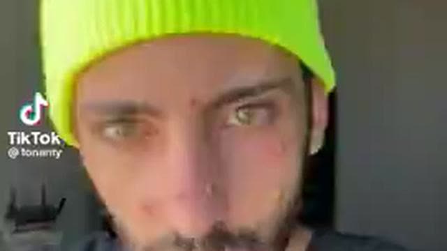 Gay dude with Monkey Pox says "Get the Vaccine"...I have a better idea