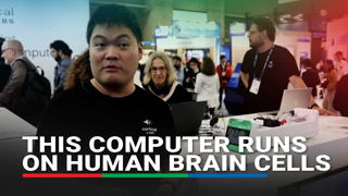 World's first computer running on living human brain cells | ABS CBN News